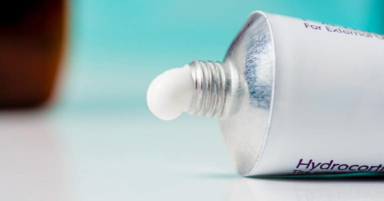 hydrocortisone cream for acne